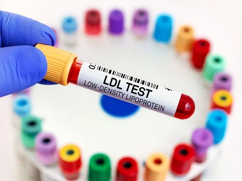 Colesterol LDL Alto: O Que É, Riscos, Metas e Tratamento