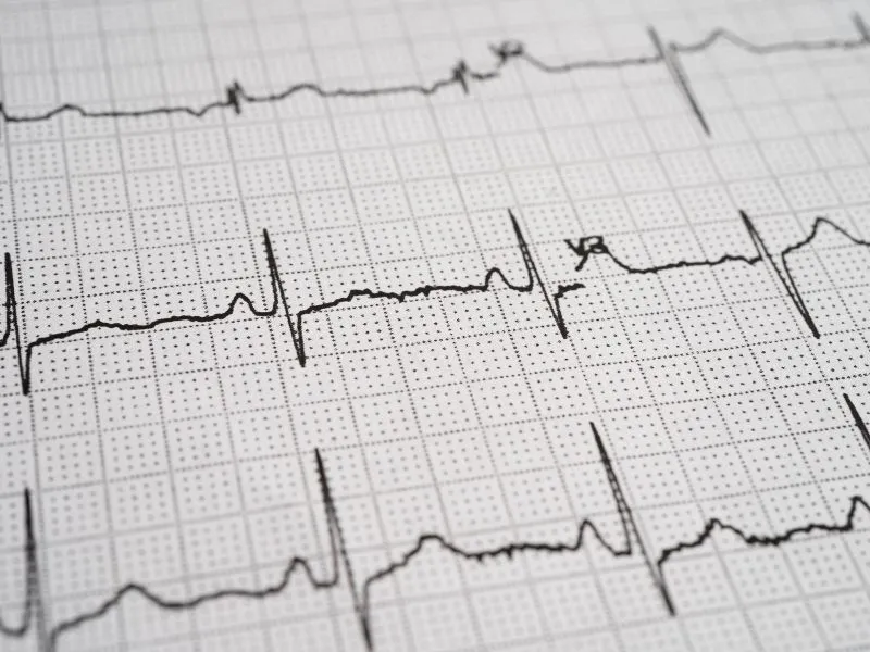 Fibrilação Atrial: O Que É, Sintomas, Riscos e Tratamento 