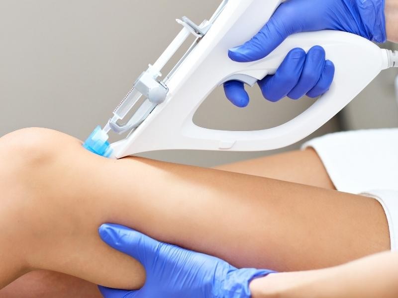Mesoterapia